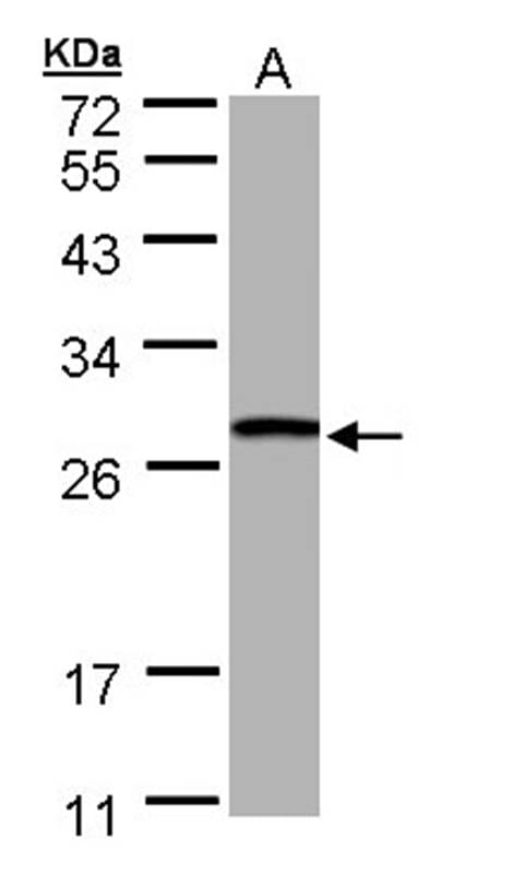 样本(30微g全细胞解析)HepG210%SDSPAGE初级抗体在1:1000时稀释