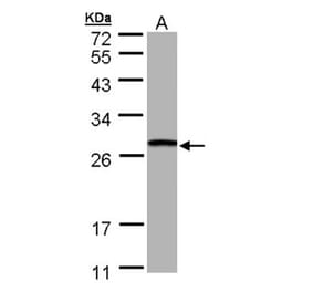 GSTT1 antibody from Signalway Antibody (22533) - Antibodies.com