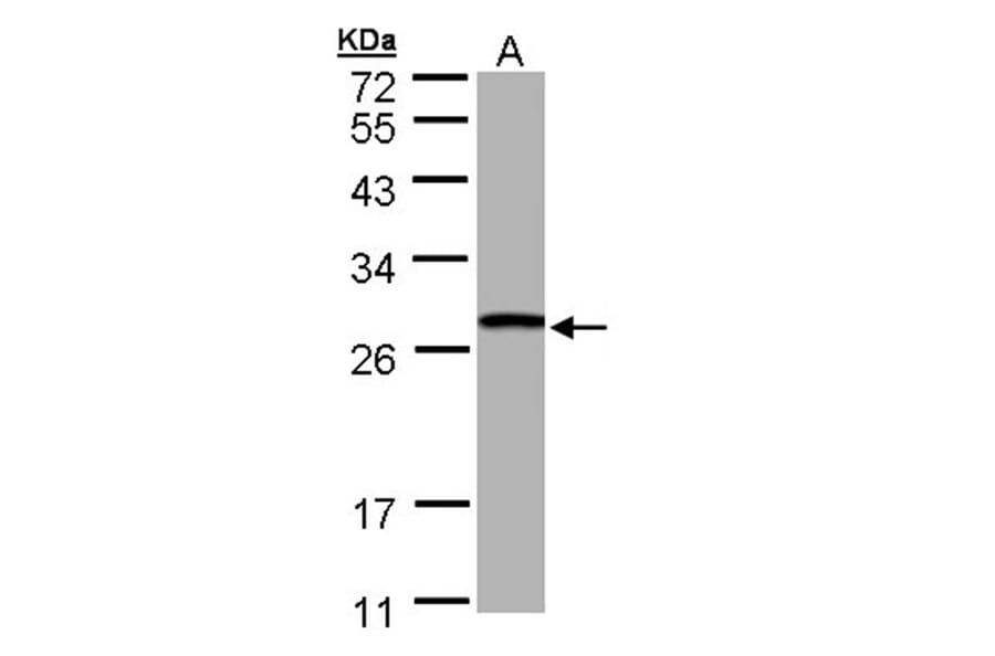 GSTT1 antibody from Signalway Antibody (22533) - Antibodies.com