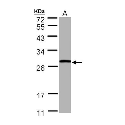 GSTT1 antibody from Signalway Antibody (22533) - Antibodies.com