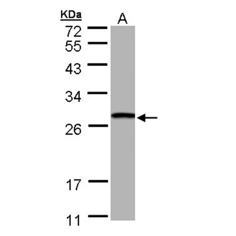 GSTT1 antibody from Signalway Antibody (22533) - Antibodies.com