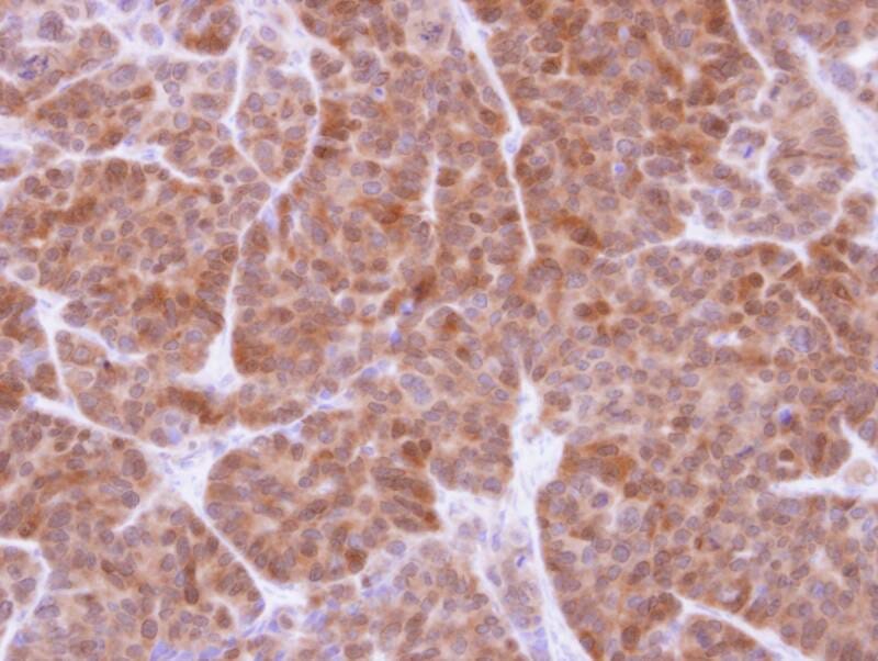 Anti-GSTT1 Antibody (A37473) | Antibodies.com
