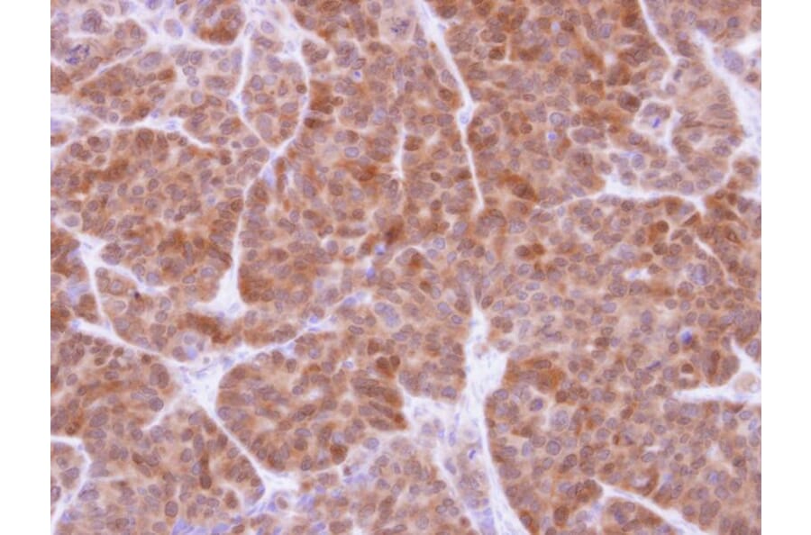Immunohistochemistry - GSTT1 antibody from Signalway Antibody (22533) - Antibodies.com