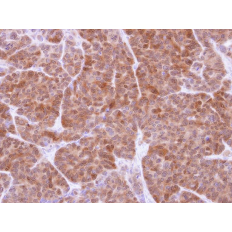 Immunohistochemistry - GSTT1 antibody from Signalway Antibody (22533) - Antibodies.com