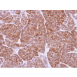 Immunohistochemistry - GSTT1 antibody from Signalway Antibody (22533) - Antibodies.com