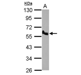 BMP10 antibody from Signalway Antibody (22534) - Antibodies.com