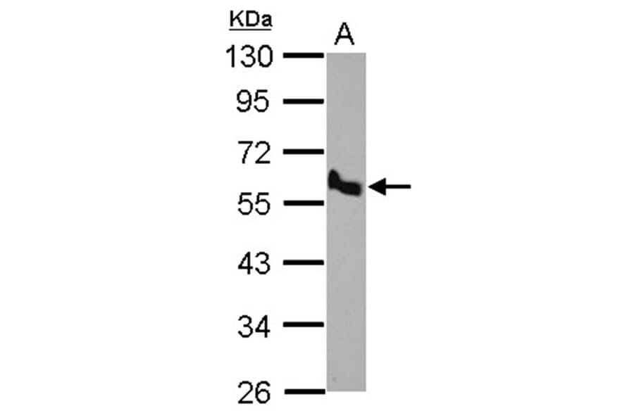 BMP10 antibody from Signalway Antibody (22534) - Antibodies.com