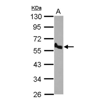 BMP10 antibody from Signalway Antibody (22534) - Antibodies.com