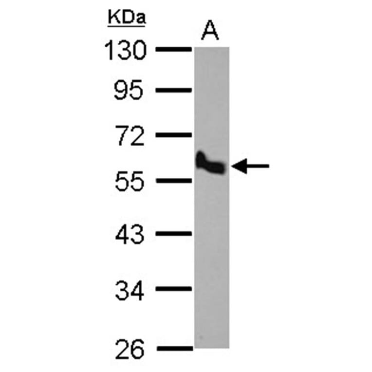 BMP10 antibody from Signalway Antibody (22534) - Antibodies.com