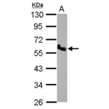 BMP10 antibody from Signalway Antibody (22534) - Antibodies.com