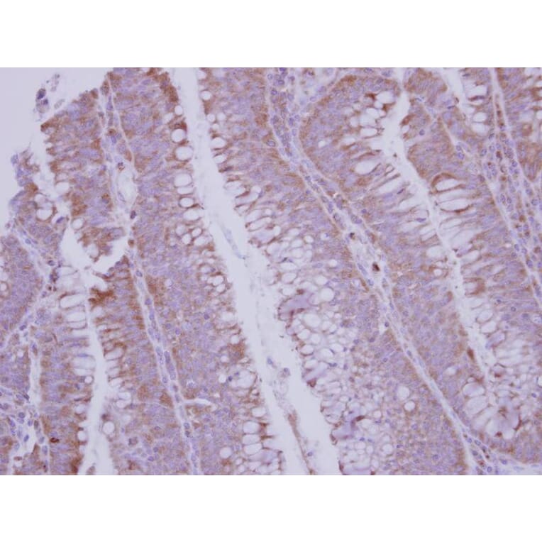 Immunohistochemistry - BMP10 antibody from Signalway Antibody (22534) - Antibodies.com