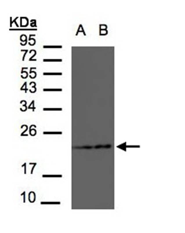 Sample (30 µg of whole cell lysate) MOLT4B: Raji12% SDS PAGE Primary antibody diluted at 1: 1500