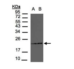 RAMP2 antibody from Signalway Antibody (22553) - Antibodies.com