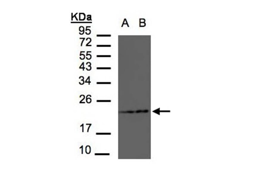 RAMP2 antibody from Signalway Antibody (22553) - Antibodies.com