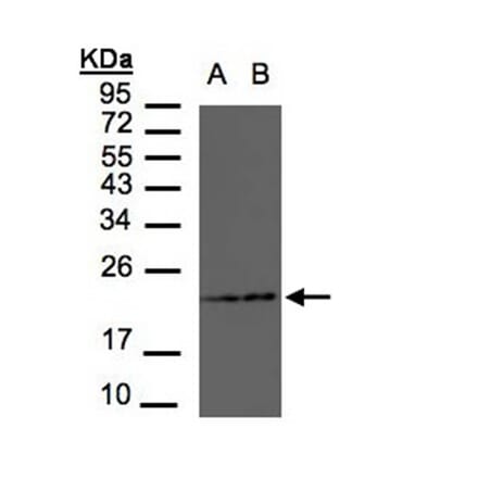 RAMP2 antibody from Signalway Antibody (22553) - Antibodies.com