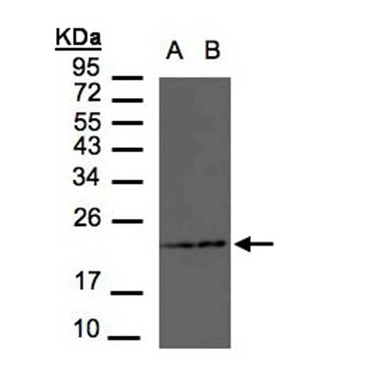 RAMP2 antibody from Signalway Antibody (22553) - Antibodies.com