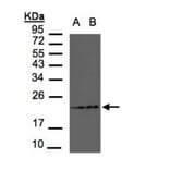 RAMP2 antibody from Signalway Antibody (22553) - Antibodies.com