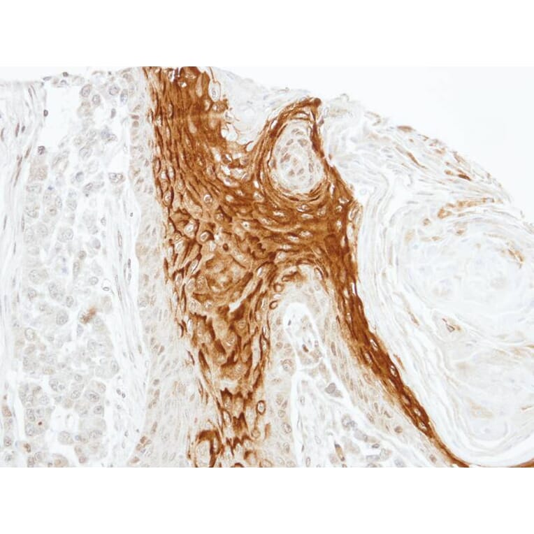 Immunohistochemistry - RAMP2 antibody from Signalway Antibody (22553) - Antibodies.com