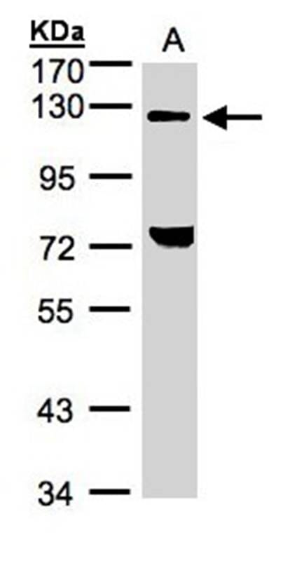 样本(30微g全细胞解析)H12997.5%SDSPAGE初级抗体稀释