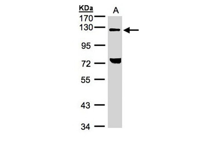 TACC2 antibody from Signalway Antibody (22575) - Antibodies.com