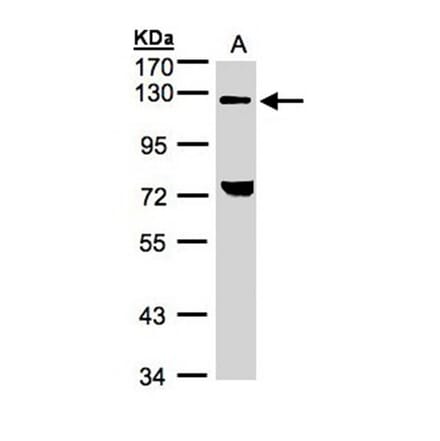 TACC2 antibody from Signalway Antibody (22575) - Antibodies.com