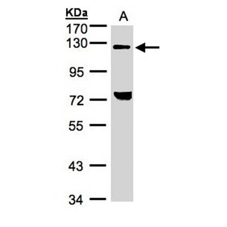 TACC2 antibody from Signalway Antibody (22575) - Antibodies.com