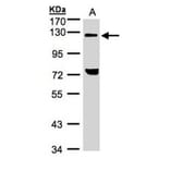 TACC2 antibody from Signalway Antibody (22575) - Antibodies.com