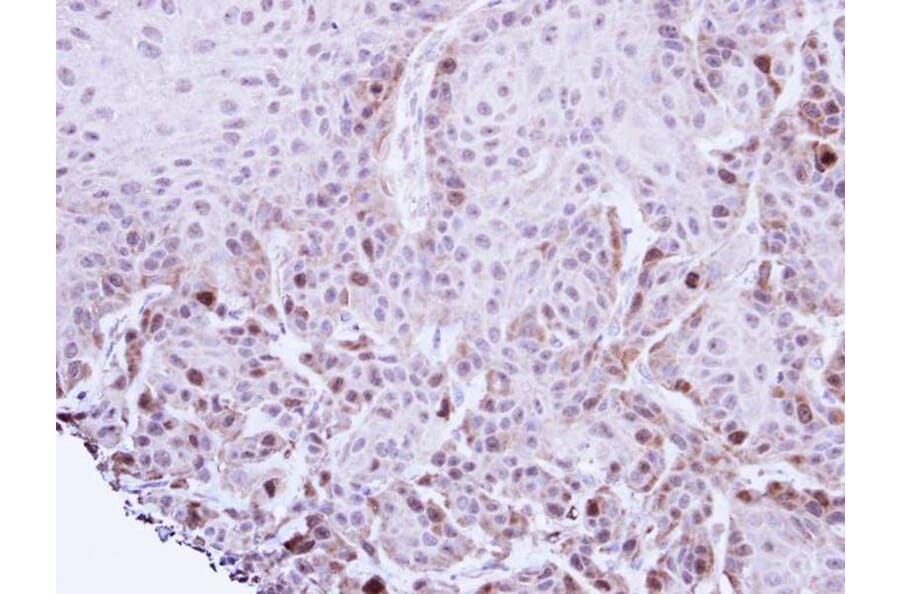 Immunohistochemistry - TACC2 antibody from Signalway Antibody (22575) - Antibodies.com