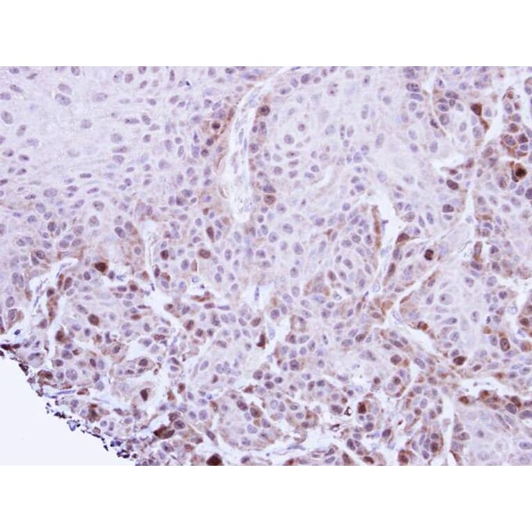 Immunohistochemistry - TACC2 antibody from Signalway Antibody (22575) - Antibodies.com