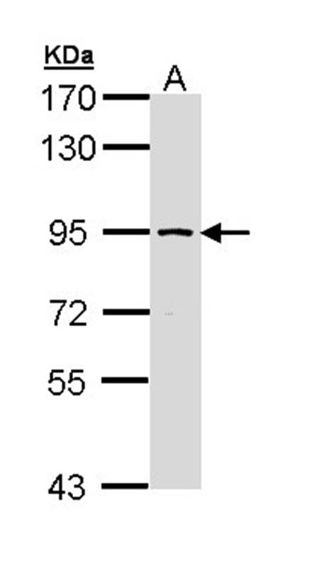 样本(30微g全细胞解析)Molt-47.5%SDSPAGE初级抗体在1:1000稀释