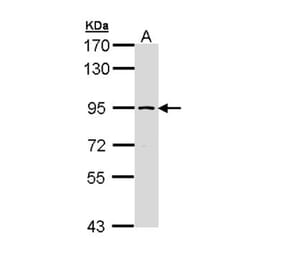 SSRP1 antibody from Signalway Antibody (22578) - Antibodies.com