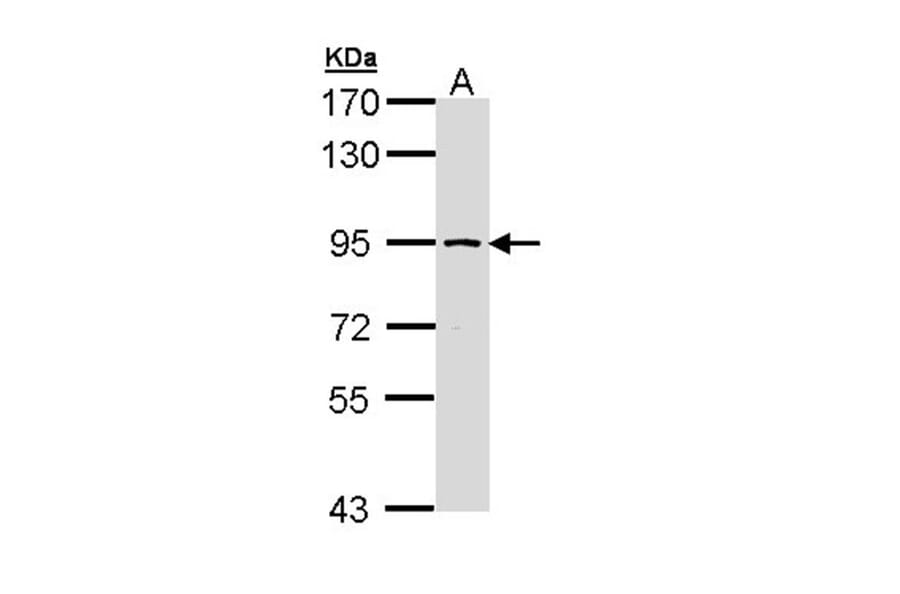 SSRP1 antibody from Signalway Antibody (22578) - Antibodies.com