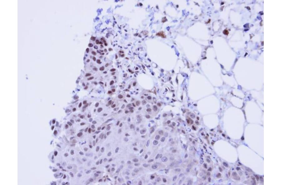Immunohistochemistry - SSRP1 antibody from Signalway Antibody (22578) - Antibodies.com