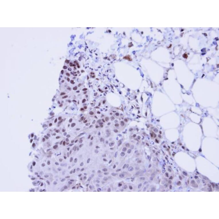 Immunohistochemistry - SSRP1 antibody from Signalway Antibody (22578) - Antibodies.com