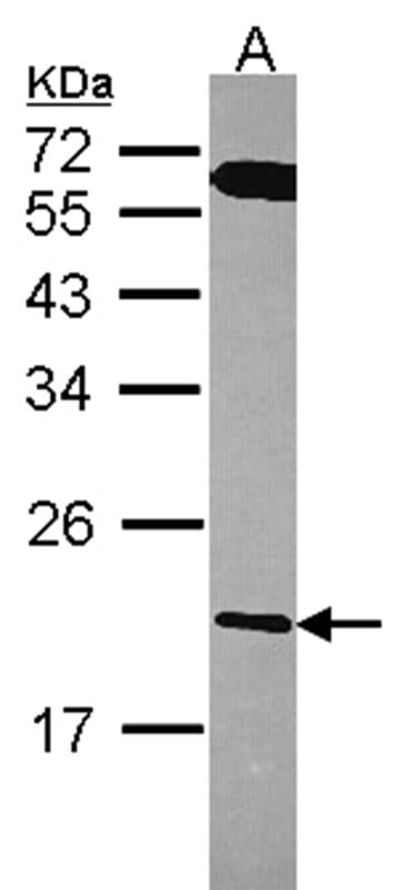 样本(30微g全细胞解析)A43112%SDSPAGE初级抗体稀释