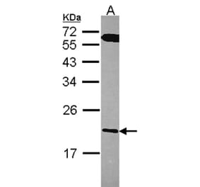 RGS10 antibody from Signalway Antibody (22586) - Antibodies.com