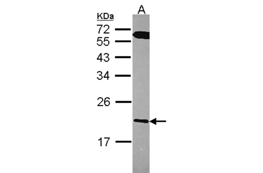 RGS10 antibody from Signalway Antibody (22586) - Antibodies.com