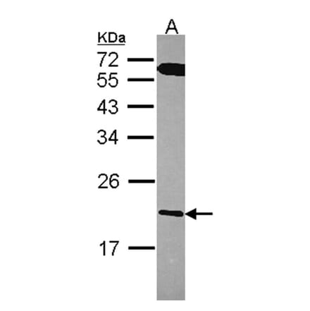 RGS10 antibody from Signalway Antibody (22586) - Antibodies.com