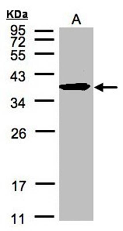 样本(全细胞解析液30微g)HELAS312%SDSPAGE初级抗体稀释