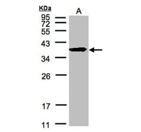 SPFH2 antibody from Signalway Antibody (22588) - Antibodies.com