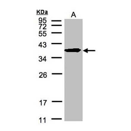 SPFH2 antibody from Signalway Antibody (22588) - Antibodies.com