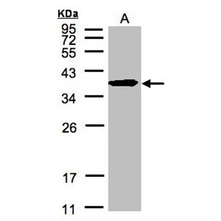 SPFH2 antibody from Signalway Antibody (22588) - Antibodies.com