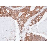 Immunohistochemistry - SPFH2 antibody from Signalway Antibody (22588) - Antibodies.com