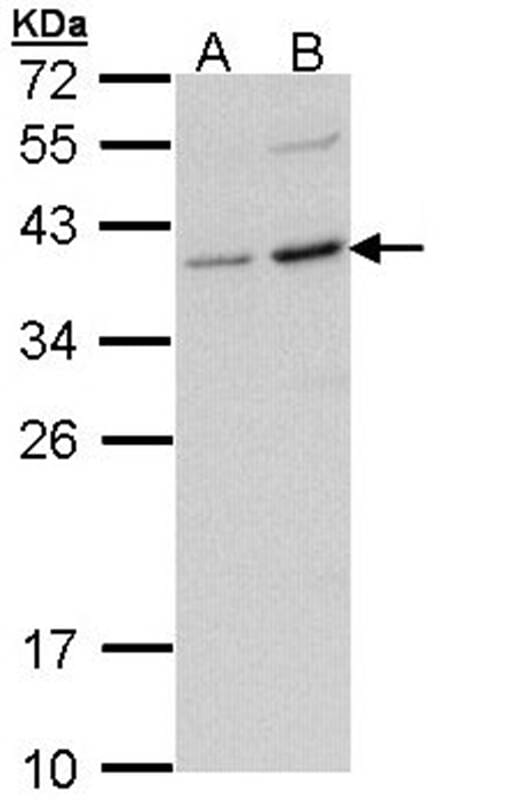 样本(30微g全细胞解析液)Molt-4B:Raji 12%SDSPAGE初级抗体在1:1000稀释