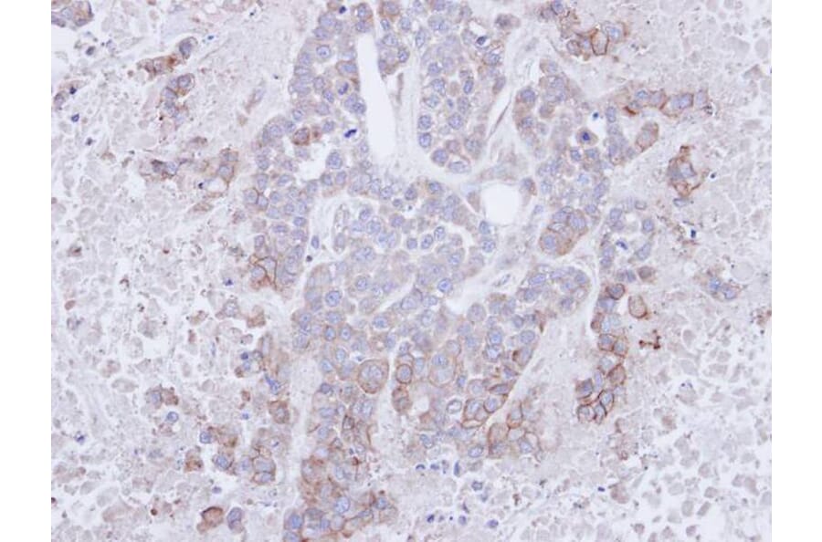 Immunohistochemistry - CD272 antibody from Signalway Antibody (22636) - Antibodies.com