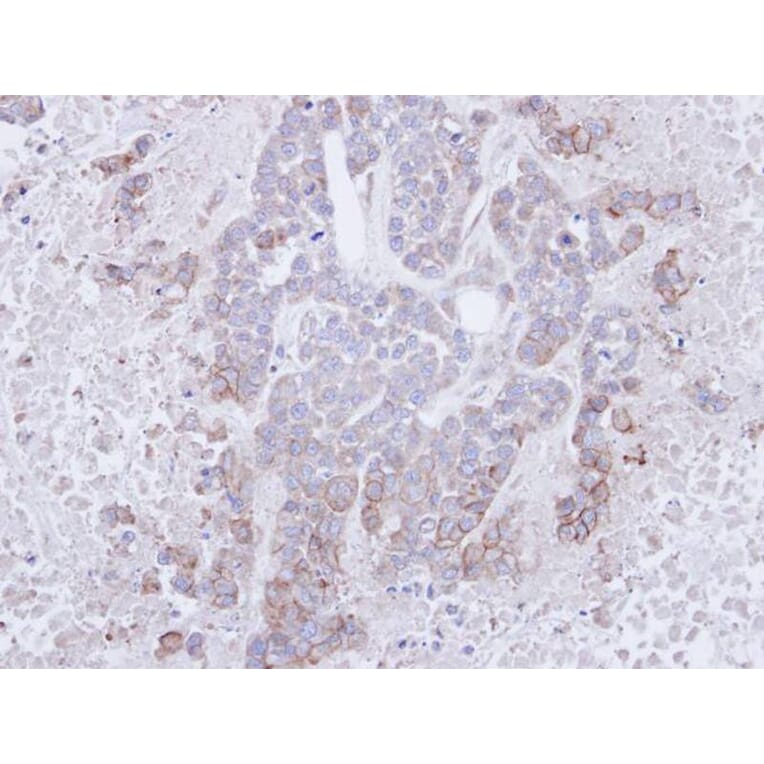 Immunohistochemistry - CD272 antibody from Signalway Antibody (22636) - Antibodies.com