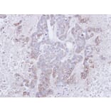 Immunohistochemistry - CD272 antibody from Signalway Antibody (22636) - Antibodies.com