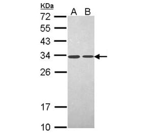 PSME3 antibody from Signalway Antibody (22679) - Antibodies.com