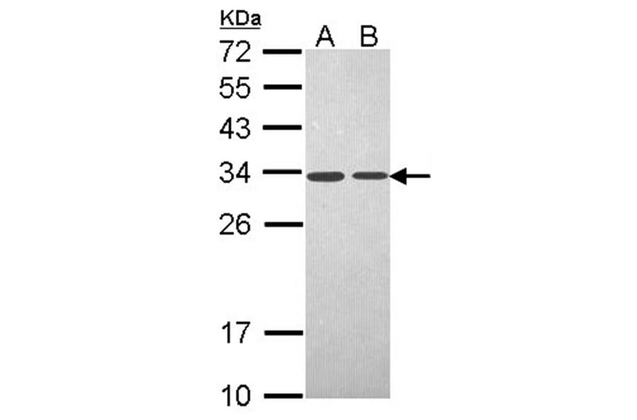 PSME3 antibody from Signalway Antibody (22679) - Antibodies.com
