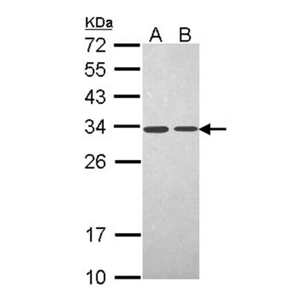 PSME3 antibody from Signalway Antibody (22679) - Antibodies.com